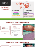 Tumor Benigno de Ovario