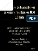 Les Ruptures Du Ligament Croisé Antérieur Revisitées en IRM 3.0 Tesla