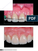 Clínica - International Journal of Brazilian Dentistry, Florianópolis, v.11, n.1, P. 30-42, Jan./mar. 2015