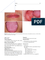 Case 50 Oral Lichen Planus (Non-Erosive Type)