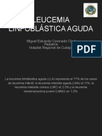 Leucemia Linfoblástica Aguda