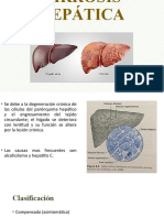 Cirrosis Hepática