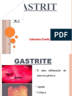 Aula 4 - Gastrite e Apendicite