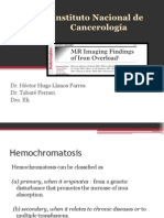 Hemochromatosis