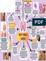 Mapa Mental Bocio y Nodulo Tiroideo