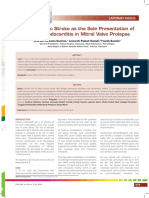 Laporan Kasus-Acute Embolic Stroke As The Sole Presentation of Infective Endocarditis in Mitral Valve Prolapse