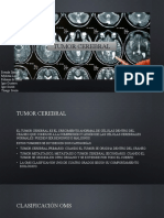 G08 - Sistema Nervioso (Tumores)