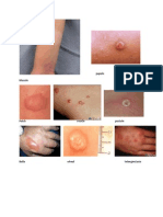 Skin Lesions