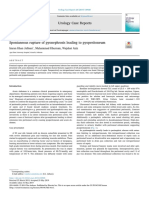 Spontaneous Rupture of Pyonephrosis Leading To Pyoperitoneum