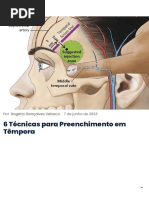 6 Técnicas para Preenchimento em Têmpora Instituto Velasco