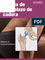 Cirugia de Reemplazo de Cadera