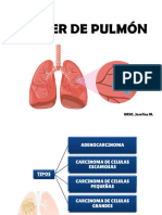 Ca de Pulmon - 2022