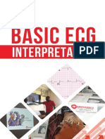 Basic ECG Interpretation