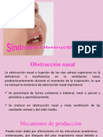 Sindrome Obstructivo Nasal