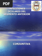 Infecciones Oculares