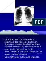 Cliché Interprété 5