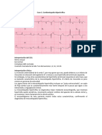 Casos ECG