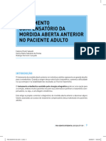 Tratamento Compensatório Da Mordida Aberta Anterior No Paciente Adulto