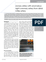 Single Coronary Artery With Anomalous Origin of Right Coronary Artery From Distal Left Circumflex Artery