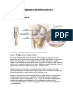 Les Lesión Del Ligamento Cruzado Anterior