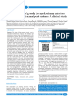 Management of Grossly Decayed Primary Anteriors