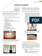 Instalação de Implantes