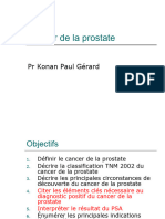 Cancer de La Prostate