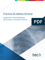 Traumatologia I Fractura de Díafisis Femoral