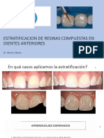 Estratificacion de Resinas Compuestas