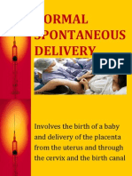 Normal Spontaneous Delivery