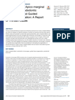 Management of Apico Marginal Defects With Endodont