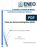 Electrocardiogram A