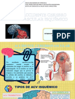 ACV Isquemico 1