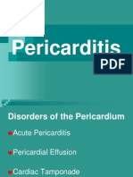 Pericarditis