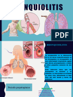 BRONQUIOLITIS