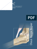 Distal Biceps Repair Using The BicepsButton™ and Tension-Slide Technique