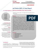 Aortic-Esophageal Fistula (AEF) - A Case Report