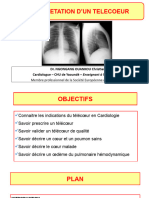 Radiographie Du Thorax - Télécoeur - 075458