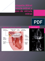 Valvulopatías Mitral