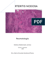 Poliarteritis Nodosa