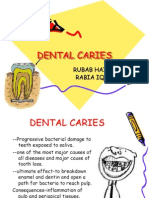 Dental Caries: Rubab Haider Rabia Iqbal