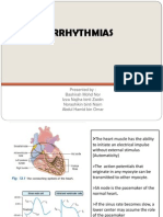 Arrhythmia A A