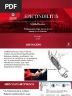 Epicondilitis