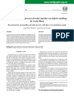 Reconstruccion de Proceso Alveolar Maxilar Con Injerto Autologo de Cresta Iliaca