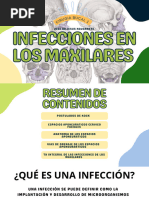 Infecciones en Los Maxilares