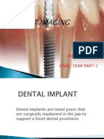 Dental Implant