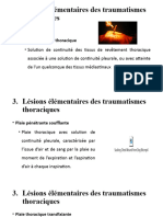 14 - SEMIOLOGIE DES TRAUMATISMES THORACIQUES - Lésions Élémentaires Des Traumatismes Thoraciques - Déroulement de L'examen D'un Traumatisé Thoracique