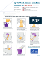 Female Condom