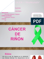 Cancer de Riñon-1