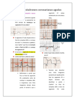 5O ECG Nas Síndromes Coronarianas Agudas